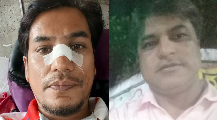 সিলেটে পৃথক ছিনতাইয়ের শিকার দুই সাংবাদিক: