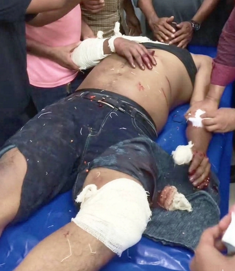 মাদক সন্ত্রাসীদের হামলার শিকার শ্রমিক ইউনিয়ন নেতা