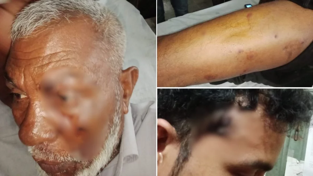 পদ্মা নদীতে টহলরত নৌ পুলিশের ওপর হামলা, ওসিসহ ৫ সদস্য গুলিবিদ্ধ