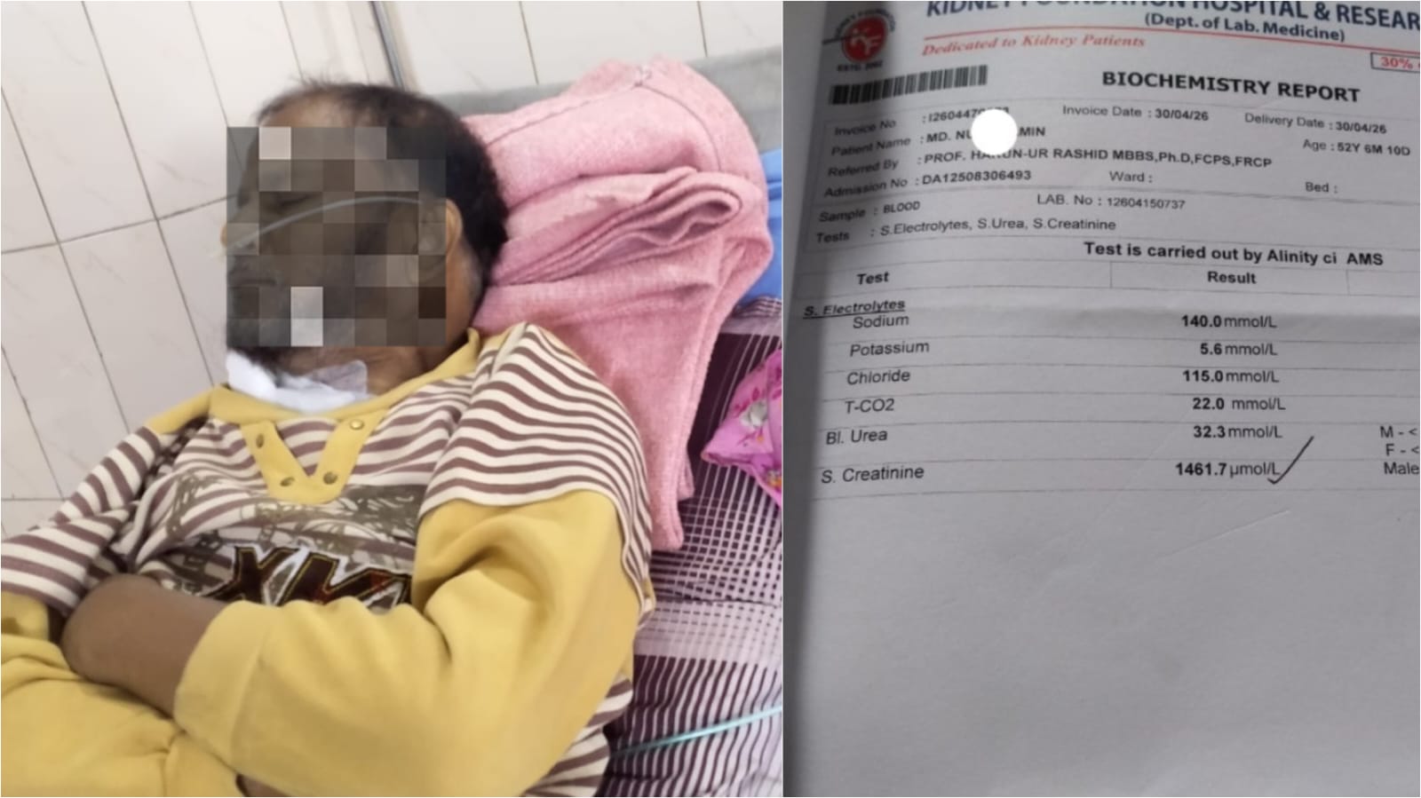 দুরারোগ্য কিডনি রোগে আক্রান্ত বাকৃবি শিক্ষার্থী নওশিনের বাবা,  মানবিক সহায়তার আবেদন