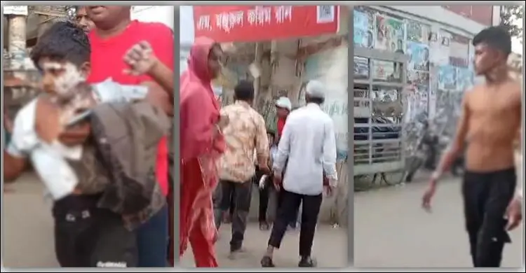 টঙ্গীতে বিএনপির গণমিছিলের প্রস্তুতিকালে গ্যাস বেলুন বিস্ফোরণ: দগ্ধ অর্ধশতাধিক