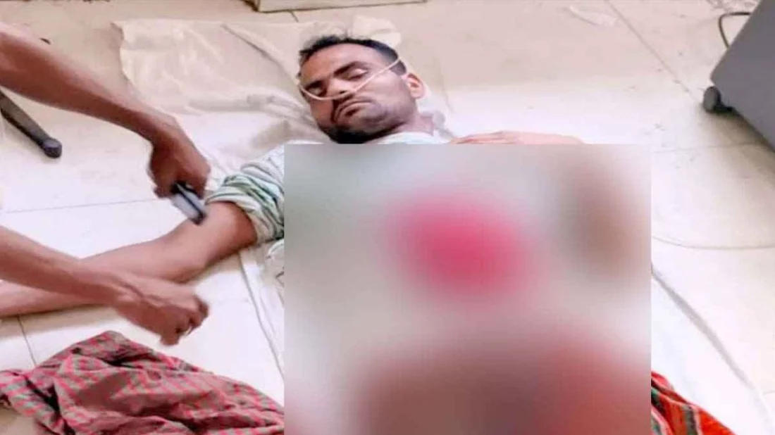 সীমান্তে বিএসএফের গুলিতে বাংলাদেশি যুবক আহত