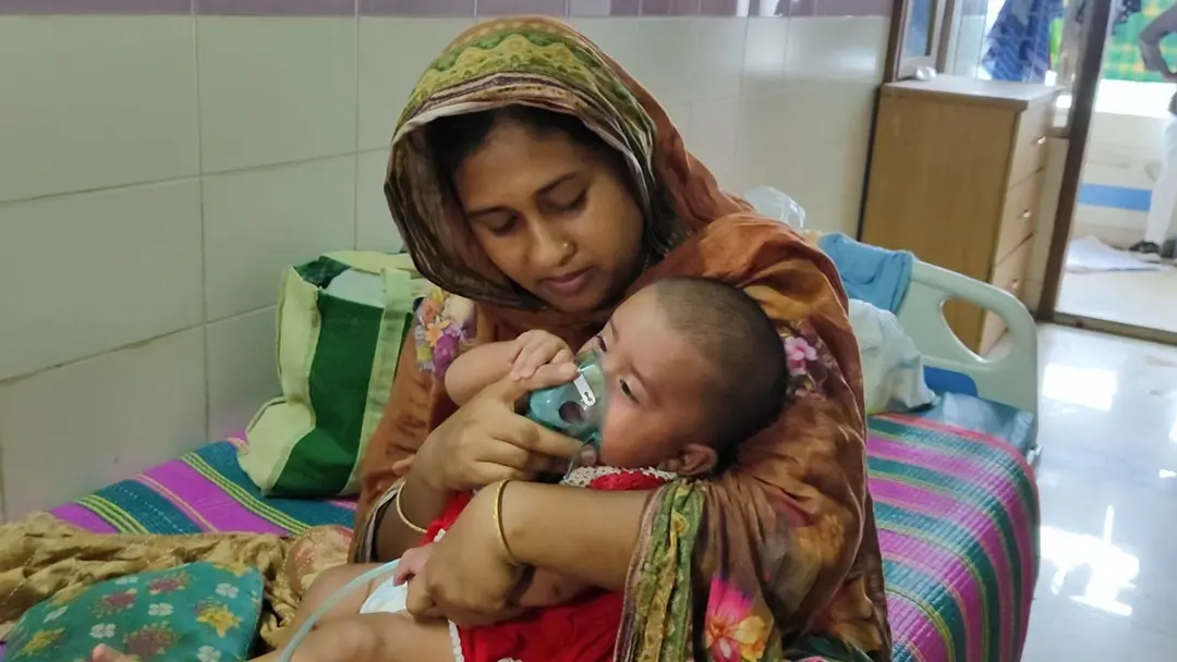 হামের লক্ষণ, নিউমোনিয়া আর টিকার সংকটে ময়মনসিংহে ১৭ দিনে ১৩ শিশুর মৃত্যু