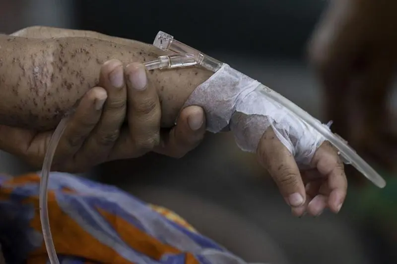 হামের উপসর্গে ২৪ ঘণ্টায় ৪ শিশুর মৃত্যু, আক্রান্ত ৮৮